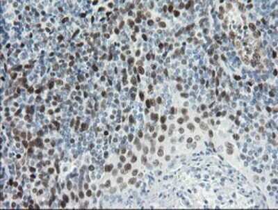 Immunohistochemistry: TLE1 Antibody (OTI1H2) [NBP2-46134]