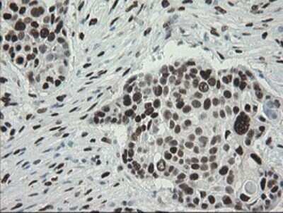 Immunohistochemistry: TLE1 Antibody (OTI1H2) [NBP2-46134]