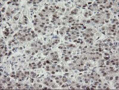 Immunohistochemistry: TLE1 Antibody (OTI1H2) [NBP2-46134]