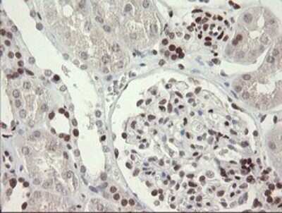 Immunohistochemistry: TLE1 Antibody (OTI1H2) [NBP2-46134]