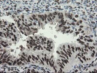 Immunohistochemistry: TLE1 Antibody (OTI1H2) [NBP2-46134]
