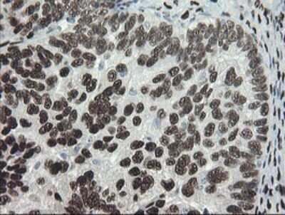 Immunohistochemistry: TLE1 Antibody (OTI1H2) [NBP2-46134]