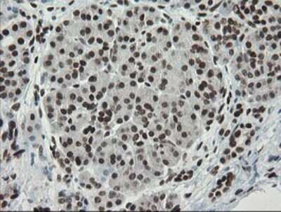 Immunohistochemistry: TLE1 Antibody (OTI1H2) [NBP2-46134]