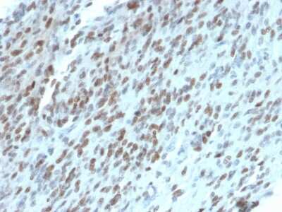 Immunohistochemistry-Paraffin: TLE1 Antibody (TLE1/2062) [NBP2-79780]
