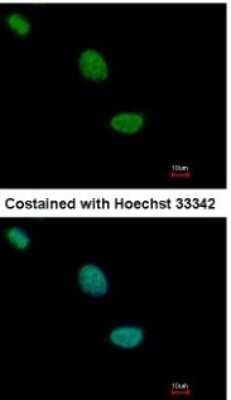 Immunocytochemistry/ Immunofluorescence: TLE2 Antibody [NBP1-32158]