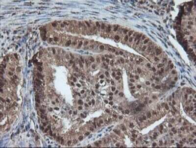 Immunohistochemistry: TLE2 Antibody (OTI5A6) - Azide and BSA Free [NBP2-74531]