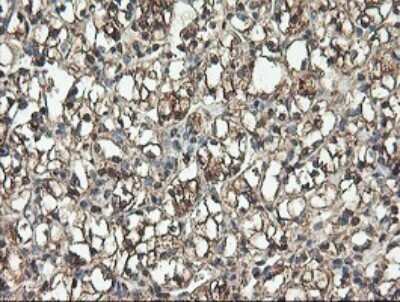 Immunohistochemistry: TLE2 Antibody (OTI5A6) - Azide and BSA Free [NBP2-74531]