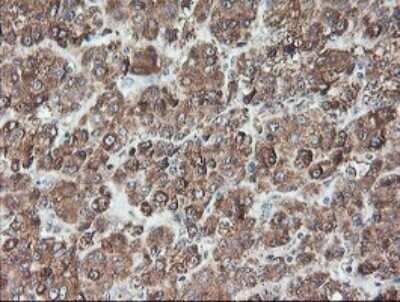 Immunohistochemistry: TLE2 Antibody (OTI5A6) - Azide and BSA Free [NBP2-74531]