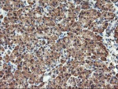 Immunohistochemistry-Paraffin: TLE2 Antibody (OTI5A6) [NBP2-01733]