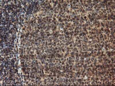 Immunohistochemistry-Paraffin: TLE2 Antibody (OTI5A6) [NBP2-01733]