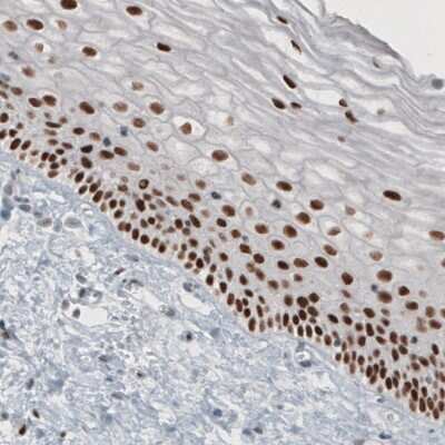 Immunohistochemistry-Paraffin: TLE3 Antibody (CL3573) [NBP2-61621]