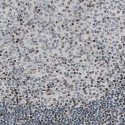 Immunohistochemistry-Paraffin: TLE3 Antibody (CL3573) [NBP2-61621]