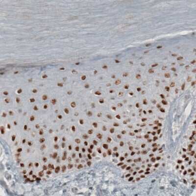 Immunohistochemistry-Paraffin: TLE3 Antibody (CL3573) [NBP2-61621]