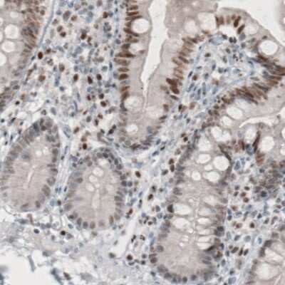 Immunohistochemistry-Paraffin: TLE3 Antibody (CL3573) [NBP2-61621]