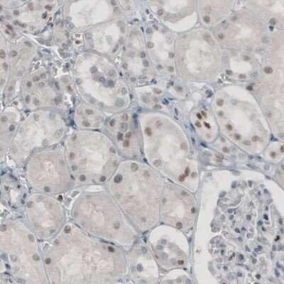 Immunohistochemistry-Paraffin: TLE3 Antibody (CL3573) [NBP2-61621]