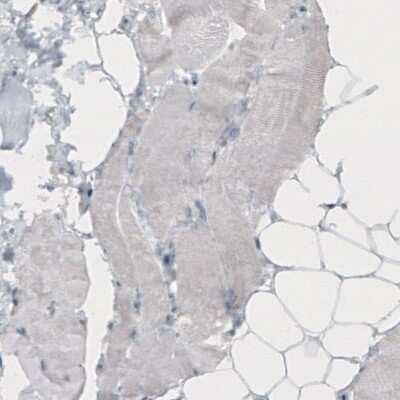 Immunohistochemistry-Paraffin: TLE3 Antibody (CL3573) [NBP2-61621]