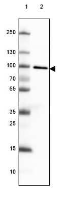 Western Blot: TLE3 Antibody (CL3573) [NBP2-61621]