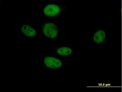 Immunocytochemistry/ Immunofluorescence: TLE3 Antibody [H00007090-B01P]