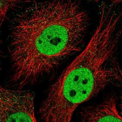 Immunocytochemistry/ Immunofluorescence: TLE3 Antibody [NBP2-30646]