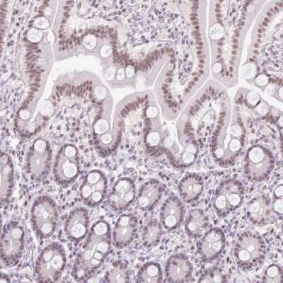 Immunohistochemistry-Paraffin: TLE3 Antibody [NBP2-30646]