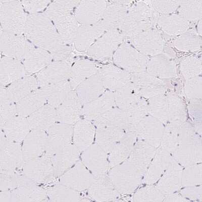 Immunohistochemistry-Paraffin: TLE3 Antibody [NBP2-30646]