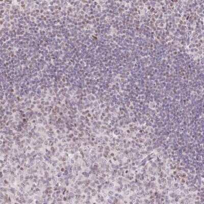 Immunohistochemistry-Paraffin: TLE3 Antibody [NBP2-30646]