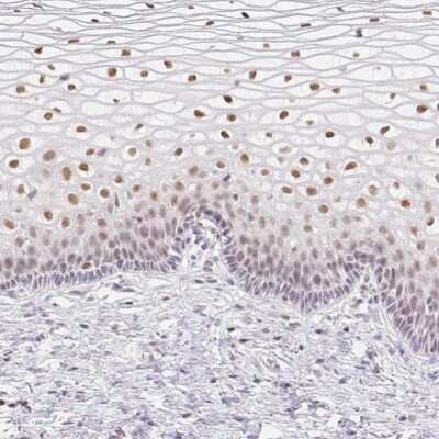 Immunohistochemistry-Paraffin: TLE3 Antibody [NBP2-30646]