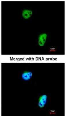 Immunocytochemistry/ Immunofluorescence: TLK1 Antibody [NBP1-32354]