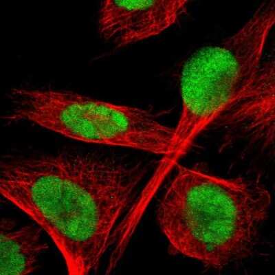 Immunocytochemistry/ Immunofluorescence: TLK1 Antibody [NBP1-83035]