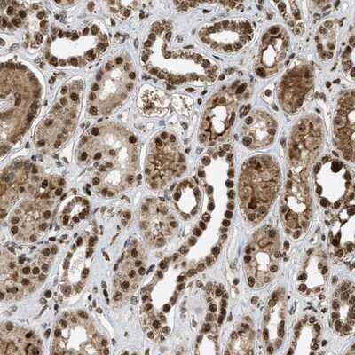 Immunohistochemistry-Paraffin: TLK1 Antibody [NBP1-83035]
