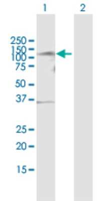 Western Blot: TLK1 Antibody [H00009874-B01P]