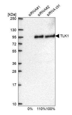 Western Blot: TLK1 Antibody [NBP1-83035]