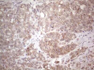 Immunohistochemistry: TLK2 Antibody (OTI2D10) [NBP2-46141]