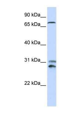 Western Blot: TLK2 Antibody [NBP1-54355]
