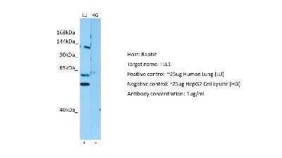 Western Blot: TLL1 Antibody [NBP2-85922]
