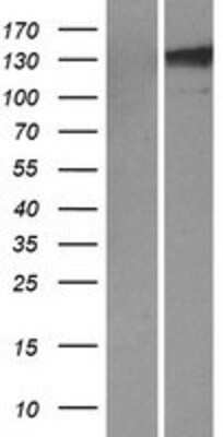 Western Blot: TLL1 Overexpression Lysate [NBP2-07439]