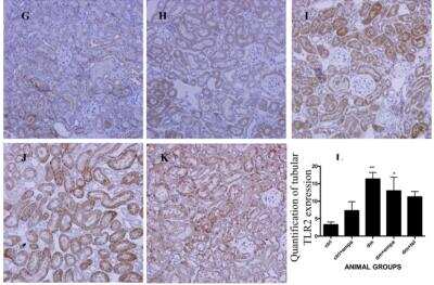Immunohistochemistry: TLR Screening Antibody Pack [NBP2-25083]