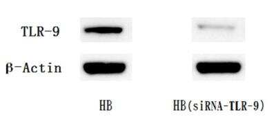 Knockout Validated: TLR Screening Antibody Pack [NBP2-25083]