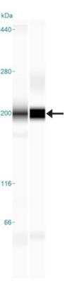 Simple Western: TLR Screening Antibody Pack [NBP2-25083]