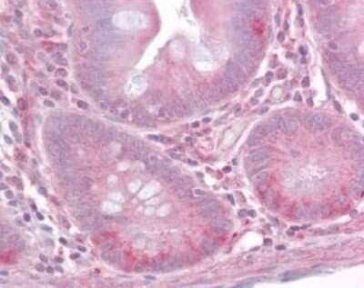 Immunohistochemistry-Paraffin: TLR1 Antibody [NB100-56563]