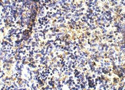 Immunohistochemistry-Paraffin: TLR1 Antibody [NBP3-12356]