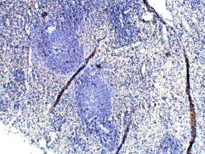 Immunohistochemistry-Paraffin: TLR1 Antibody [NBP3-12356]