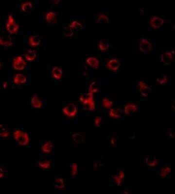 Immunocytochemistry/ Immunofluorescence: TLR11 Antibody - BSA Free [NBP1-77204]