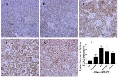 Immunohistochemistry: TLR2 Antibody - Azide Free [NBP2-24861]