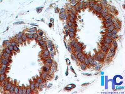 Immunohistochemistry: TLR2 Antibody (67N17F8) - Azide and BSA Free [NBP2-80980]