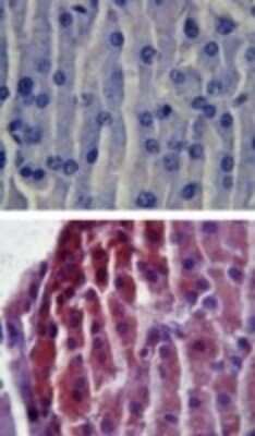 Immunohistochemistry-Paraffin: TLR2 Antibody [NB100-56720]