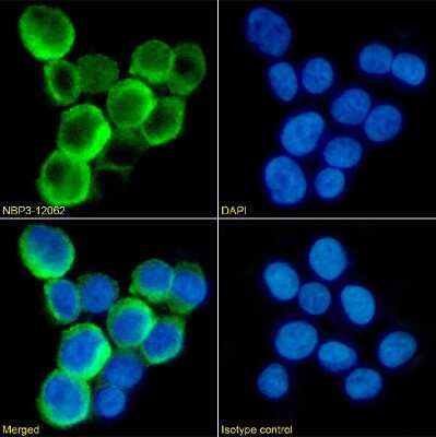 Immunocytochemistry/ Immunofluorescence: TLR2 Antibody (TL2.1) - Chimeric - Azide and BSA Free [NBP3-12062]