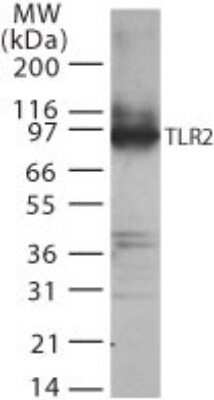 Western Blot: TLR2 Antibody [NB100-56720]