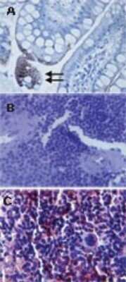 Immunohistochemistry: TLR3 Antibody (40C1285.6) - Azide Free [NBP2-33263]