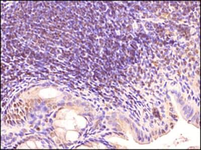 Immunohistochemistry-Paraffin: TLR3 Antibody (40C1285.6) - BSA Free [NBP2-24875]